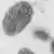 Microscopic image of a smallpox virus