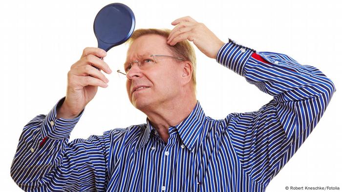 Symbolbild Geheimratsecken (Robert Kneschke/Fotolia)
