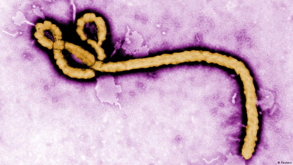 Obat Eksperimental Terhadap Ebola Sulut Debat Iptek Laporan Seputar Sains Dan Teknologi Dan Lingkungan Dw 08 08 2014