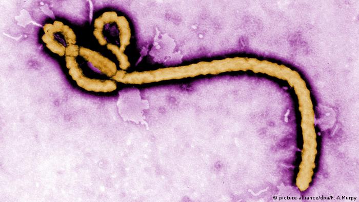 Ebola virus Photo: EPA/FREDERICK A. MURPY/CDC