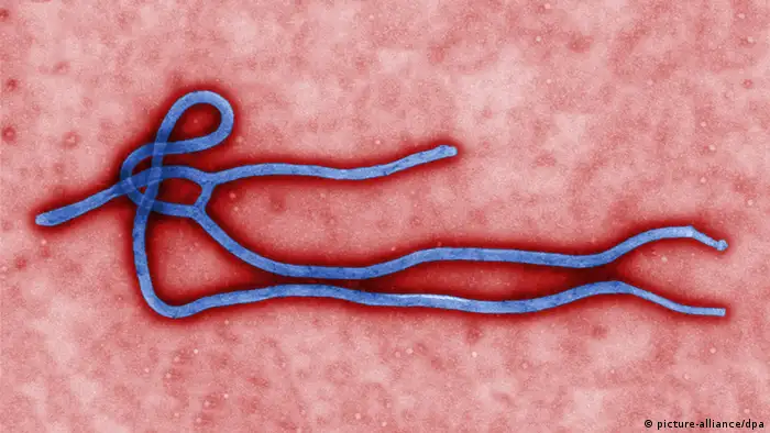 Symbolbild - Ebola Virus