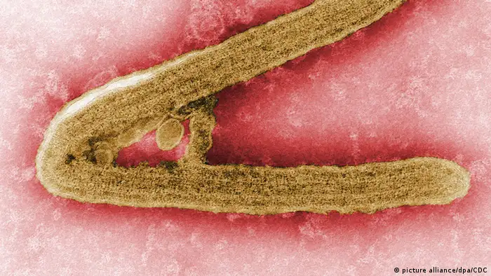 Marburg Virus (picture alliance/dpa/CDC)