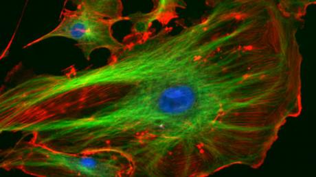 Nobelpreis 2014 Chemie Zellstrukturen Fluoreszenzmikroskopie