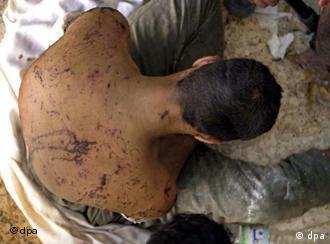 Gefolterter Iraker Tag der Menschenrechte Folter
