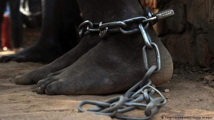 A black leg in chains