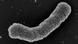 Elektronenmikroskopische Aufnahme des Teixobactin-Produzenten Eleftheria terrae. (Foto: William Fowley/Northeastern University) Elektronenmikroskopische Aufnahme des Teixobactin-Produzenten Eleftheria terrae. (Foto: William Fowley/Northeastern University)