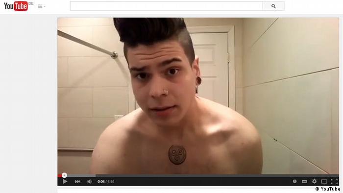 Matt Diaz Strips Off To Show Excess Skin From Weight Loss Raises 50k To Have It Removed Americas North And South American News Impacting On Europe Dw 23 03 2015