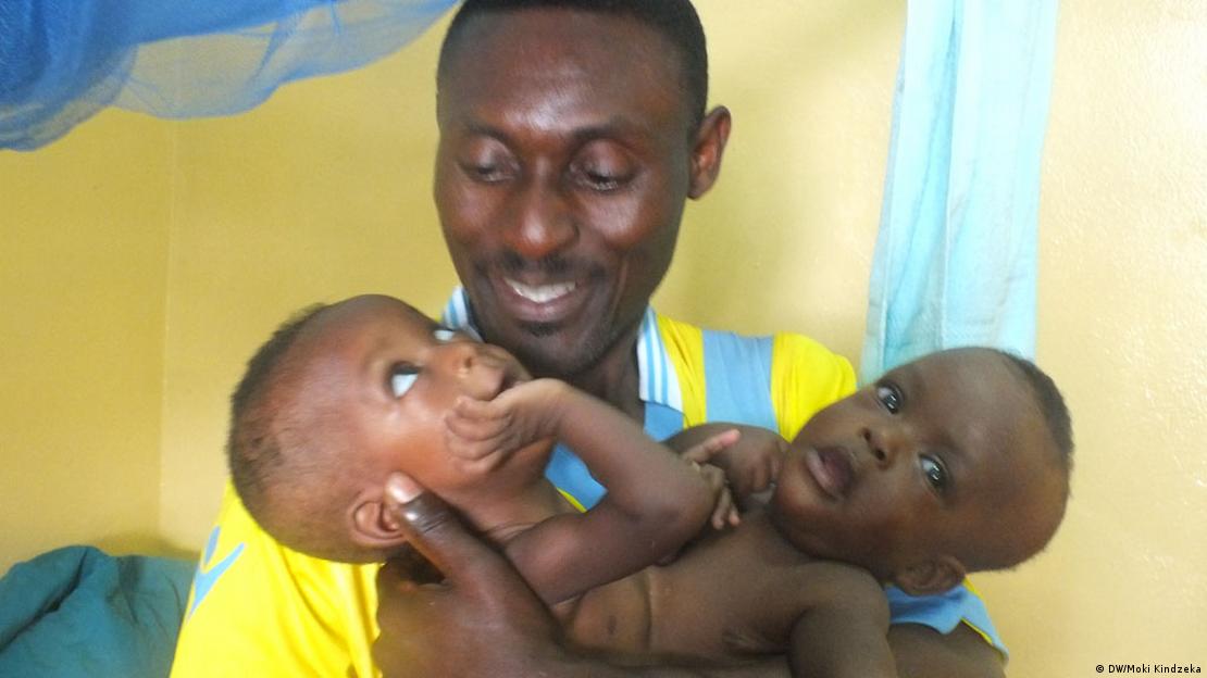 A Cameroonian father holds his siamese twins in Yaounde.