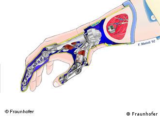 اليد المستقبلية: أحد مشاريع معهد فراونهوفر للأبحاث الطبية