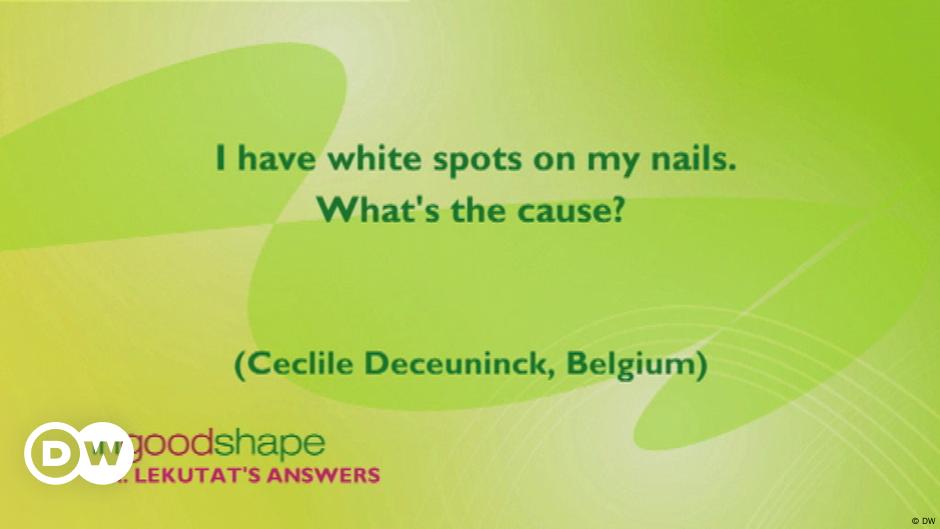 i-have-white-spots-on-my-nails-what-s-the-cause-dw-08-11-2015