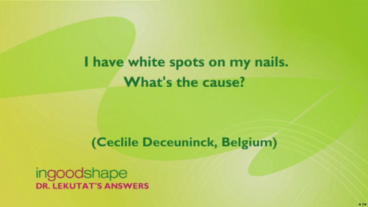 I have white spots on my nails. What's the cause? – DW – 08/11/2015