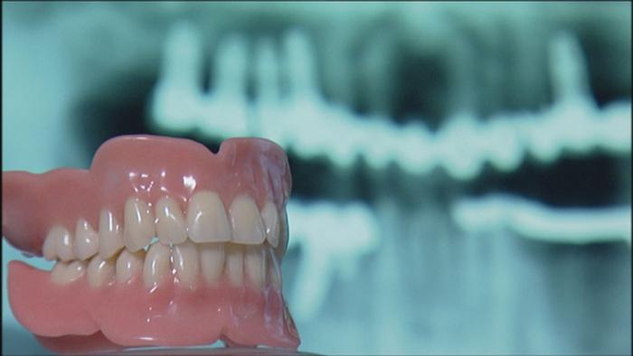 زراعة الأسنان.. فوائدها ومخاطرها | منوعات | نافذة DW عربية على حياة  المشاهير والأحداث الطريفة | DW | 09.10.2015