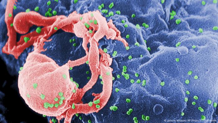 Symbolbild HIV-Virus (picture-alliance/AP Photo/C. Goldsmith)