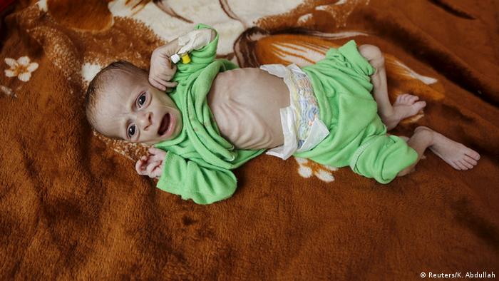 Jemen Kinder Hunger (Reuters/K. Abdullah)