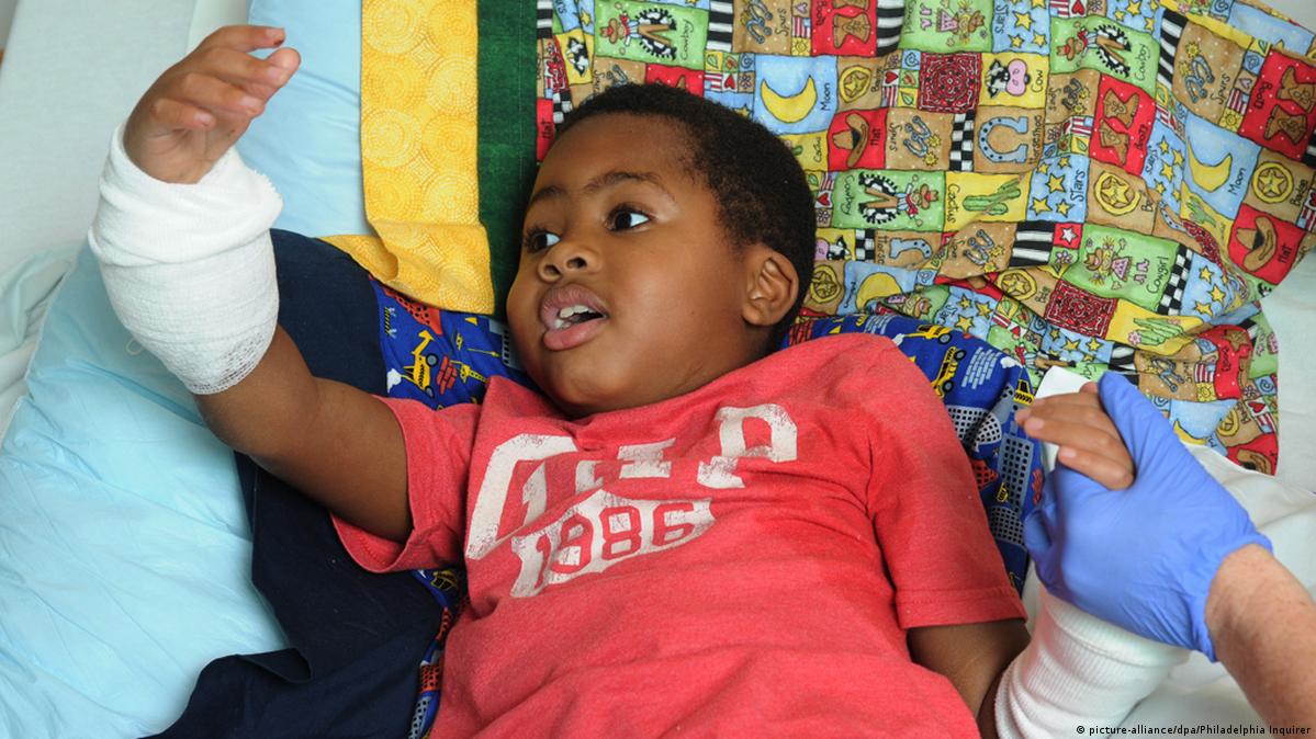 US boy gets new hands in milestone operation – DW – 07/29/2015