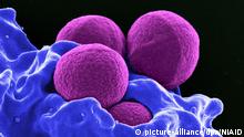 HANDOUT - Produced by the National Institute of Allergy and Infectious Diseases (NIAID), this digitally-colorized scanning electron micrograph (SEM) depicts four magenta-colored, spherical methicillin-resistant Staphylococcus aureus (MRSA) bacteria that were in the process of being phagocytized by a blue-colored human white blood cells (WBCs) known specifically as a neutrophil. One form of Staphylococcus aureus bacteria known as methicillin-resistant Staphylococcus aureus, or MRSA, causes a range of illnesses, from skin and wound infections to pneumonia and bloodstream infections that can cause sepsis and death. Staph bacteria, including MRSA, are one of the most common causes of healthcare-associated infections. Resistance to methicillin and related antibiotics (e.g., nafcillin, oxacillin) and resistance to cephalosporins are of concern. CDC estimates 80,461 invasive MRSA infections and 11,285 related deaths occurred in 2011. An unknown but much higher number of less severe infections occurred in both the community and in healthcare settings. Photo: National Institute of Allergy and Infectious Diseases (NIAID)/dpa (zu: Umfrage: Wenig Wissen über Antibiotika und Resistenzen; ACHTUNG: Nur zur redaktionellen Verwendung im Zusammenhang mit der aktuellen Berichterstattung und nur bei Nennung: Foto: National Institute of Allergy and Infectious Diseases (NIAID)/dpa