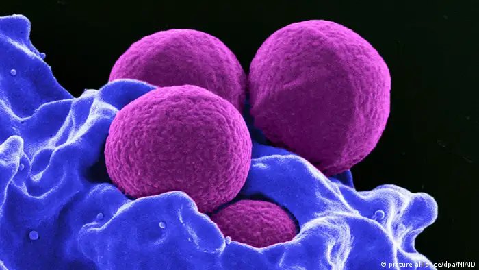Staphylococcus aureus MRSA (picture-alliance/dpa/NIAID)