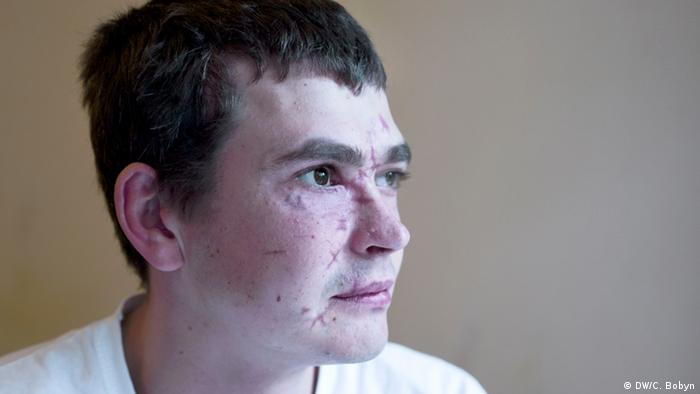 28-летний Андрей, призывник из Киева, подорвался на мине в Донецкой области. 