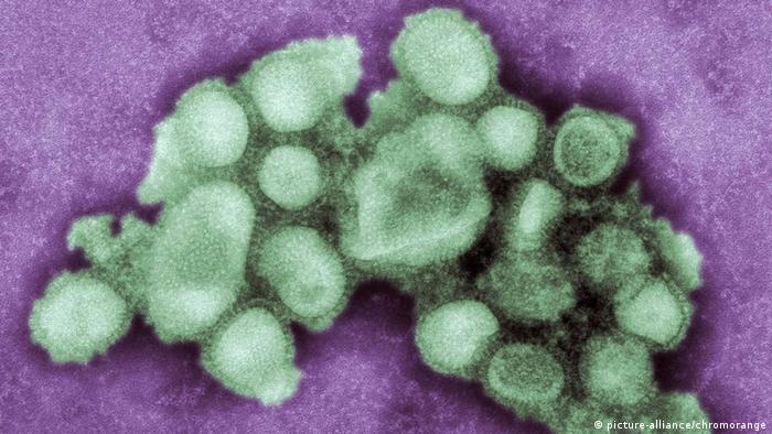 A close up of the H1N1 swine flu virus