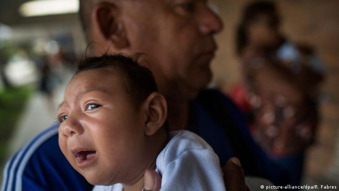 Brasilien Recife Kind mit Mikrozephalie