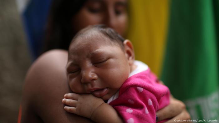 A Brazilian baby with microcephaly (picture-alliance/dpa/A. Lacerda)