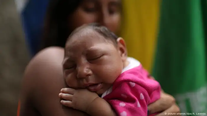A Brazilian baby with microcephaly (picture-alliance/dpa/A. Lacerda)