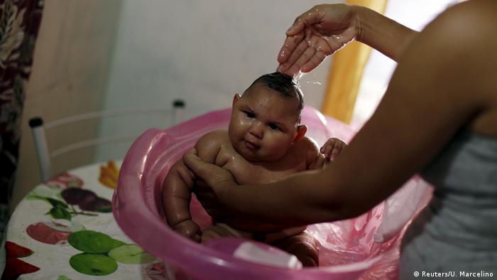 Brasilien Zika Virus - Mikrozephalie - Mutter mit Baby