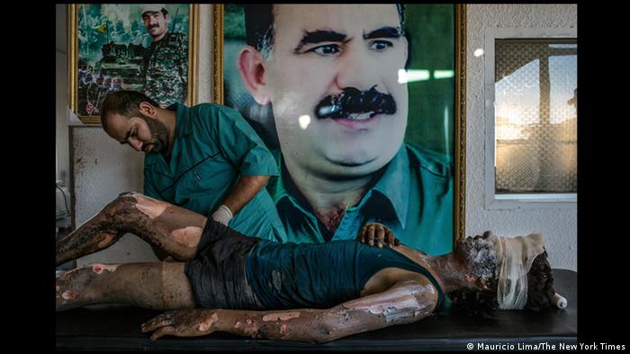 World Press Photo 2016 Kategorie General news Mauricio Lima Kurdischer Arzt behandelt IS Kämpfer