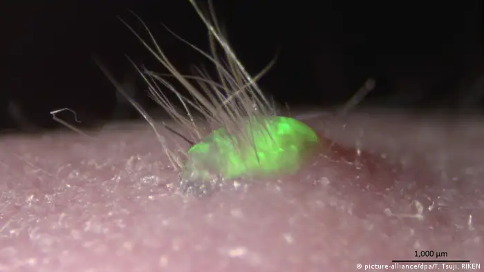 Forscher erschaffen Haut mit Haaren und Talgdrüsen