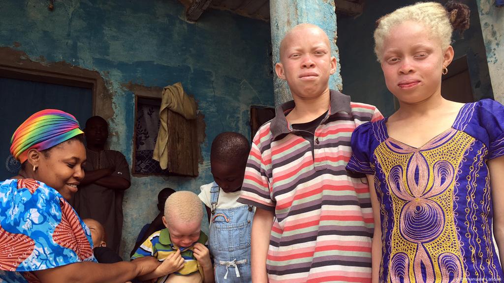 sunscreen for albinos