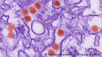 Virus del Zika observado con el microscopio electrónico.