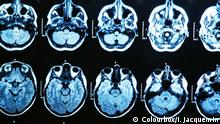 Gehirn Symbolbild MRI scan of the human brain (c) Colourbox/I. Jacquemin