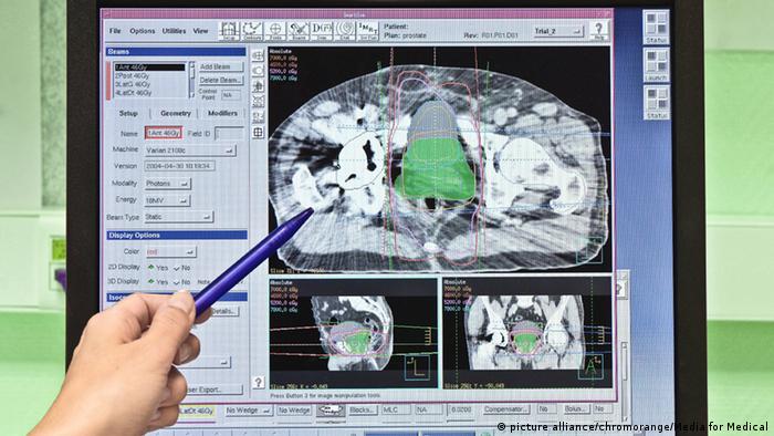 Reconocimiento de cáncer matriz a través de resonancia magnética