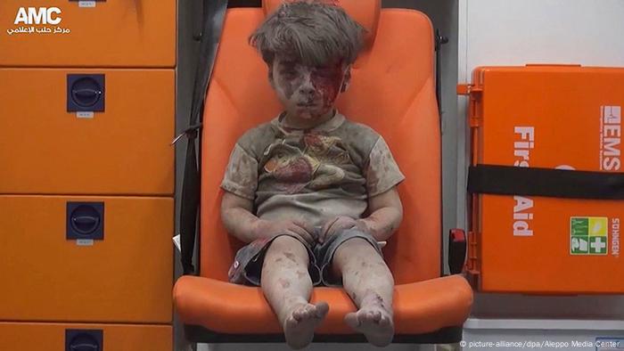 Boy injured in war in Aleppo 