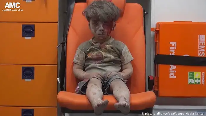 Omran Daqneesh Aleppo verletzter Junge