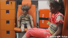 Derita Sunyi Bocah Korban Perang Suriah