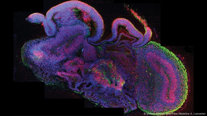 Organoid Miniatur-Gehirn aus dem Labor (picture-alliance/dpa/Imba/Madeline A. Lancaster)