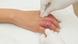 Symbolbild Verletzung an der Hand Symbolbild Verletzung an der Hand