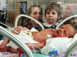 柏林：四胞胎中的一员躺在育婴箱里
