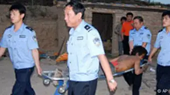 China Sklavenarbeit Verletzter bei Hongtong
