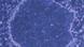 Human induced pluripotent stem cells, or iPS cells, are shown in this undated photo released by Kyoto University Prof. Shinya Yamanaka Human induced pluripotent stem cells, or iPS cells, are shown in this undated photo released by Kyoto University Prof. Shinya Yamanaka