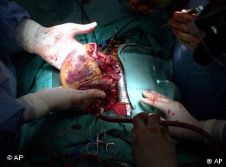 Ein Arzt hält ein menschliches Herz in den Händen (AP Photo/Jamie-Andrea Yanak)