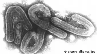 Elektronenmikroskopische Aufnahme des Marburg-Virus