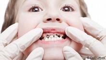 الأسنان للاطفال صحة افكار عن