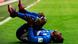 1. Bundesliga - FC Augsburg - FC Schalke 04 - Breel Embolo verletzt 1. Bundesliga - FC Augsburg - FC Schalke 04 - Breel Embolo verletzt
