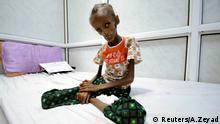 Jemen Unterernährung (Reuters/A.Zeyad)