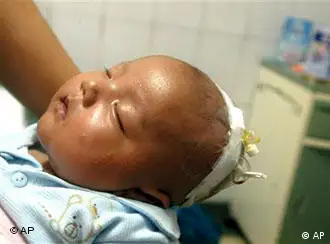 A baby suffering from kidney stone after drinking Sanlu brand milk powder rests at a hospital in Ziyang of southwest China's Sichuan province Saturday, Sept. 13, 2008. China's health minister has blamed the company for a delay in warning the public about tainted milk powder linked to the sickening of 432 babies and at least one death.(AP Photo/Color China Photo) ** CHINA OUT **