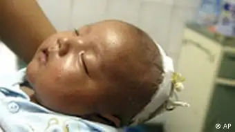 China Baby Milch Skandal Sanlu