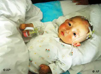 中国毒奶粉的受害幼儿