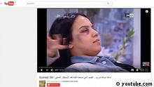 قناة مغربية تعتذر عن بثها فقرة لإخفاء أثر الضرب عن وجه المرأة
